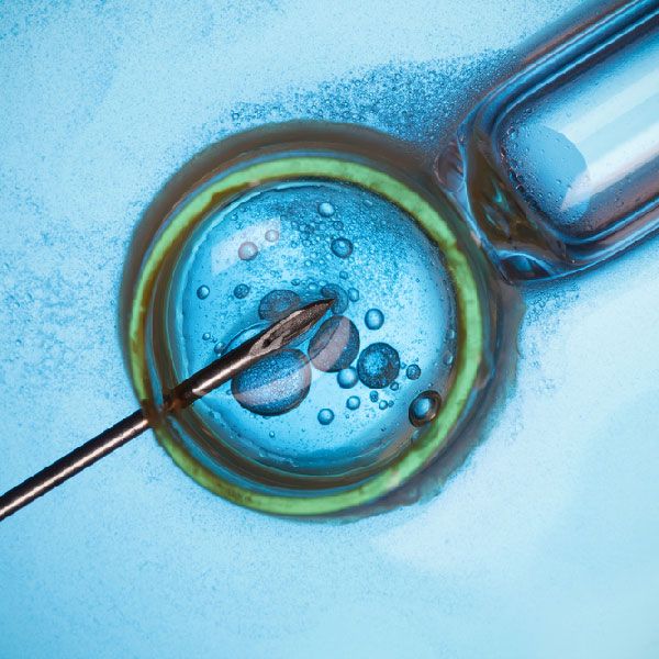 Fertilization process in lab